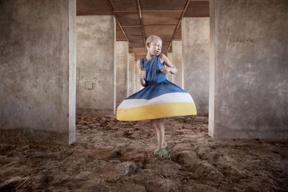 Photographic Social Vision - 01_ALBINO©ANA_PALACIOS-e1746782730634